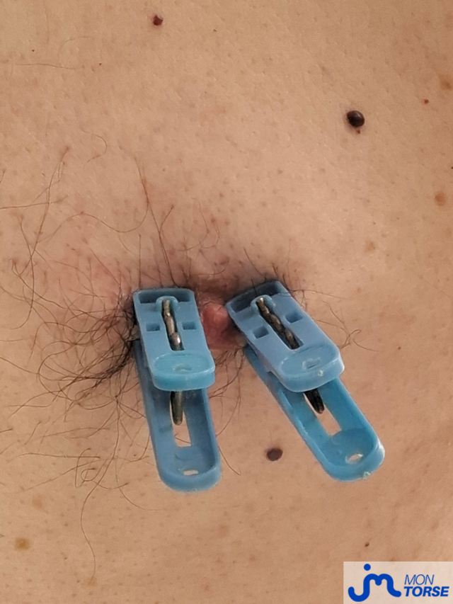 torses de basenhau