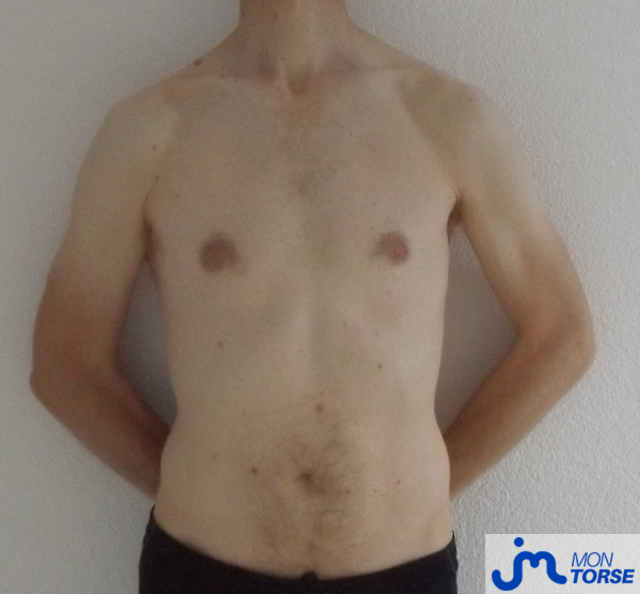 Photos de torses : C Moi