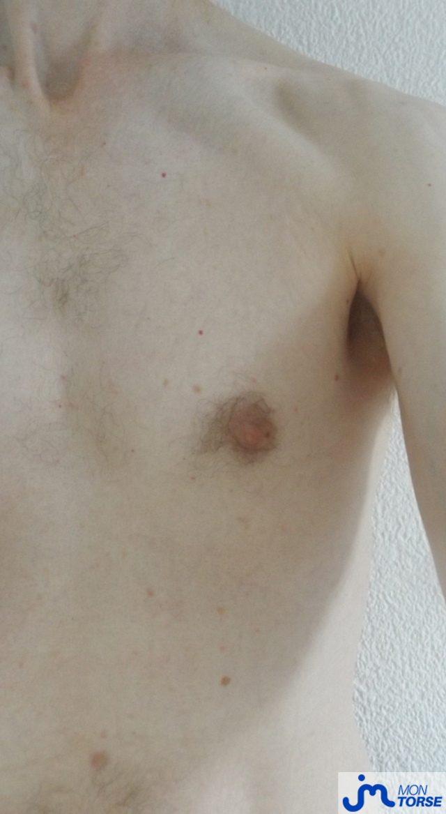 torses de SOLO68