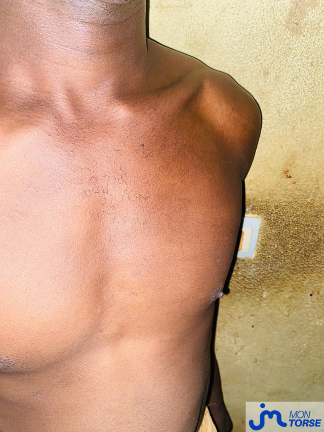 Photos de torses : Un corps solitaire 