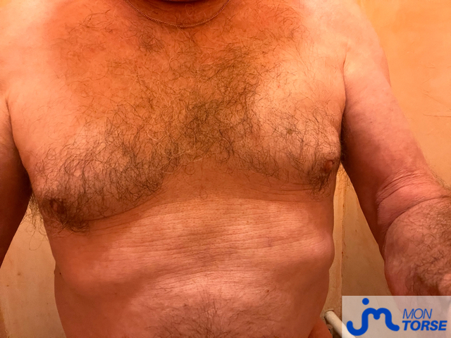 Photos de torses : 1ere contribution 