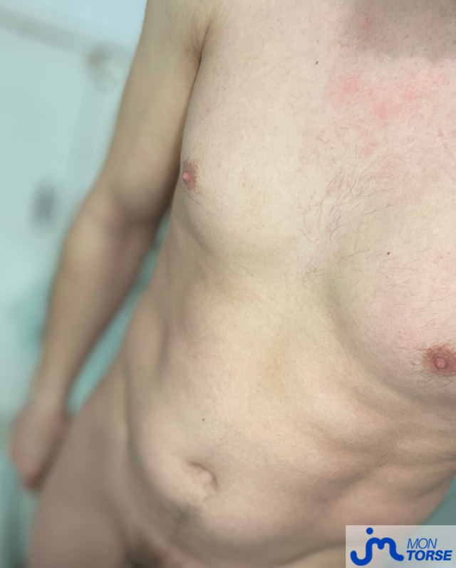 Photos de torses : Moi