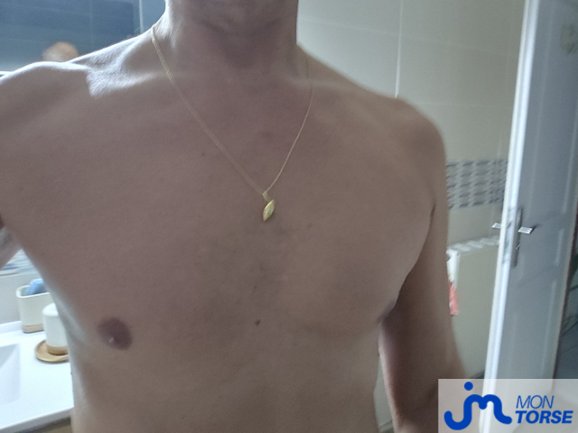 torses de lechat31