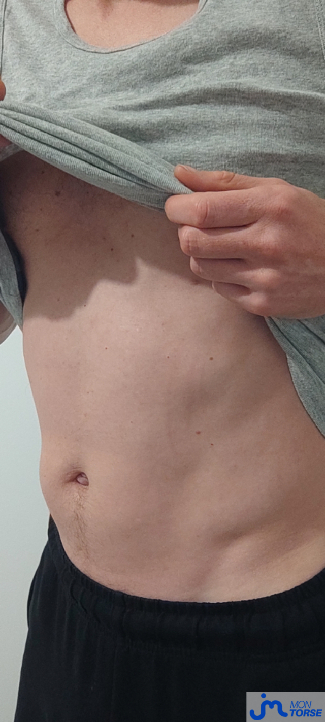 torses de echocoon31