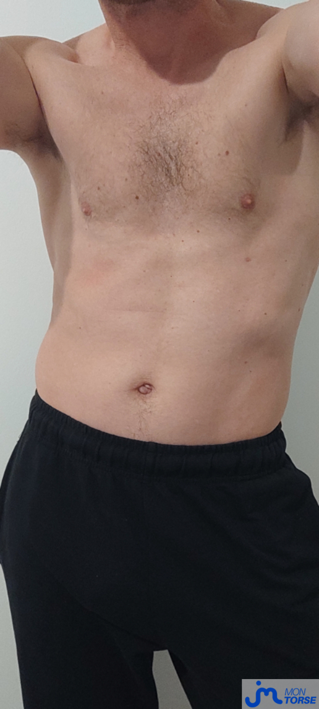 torses de echocoon31