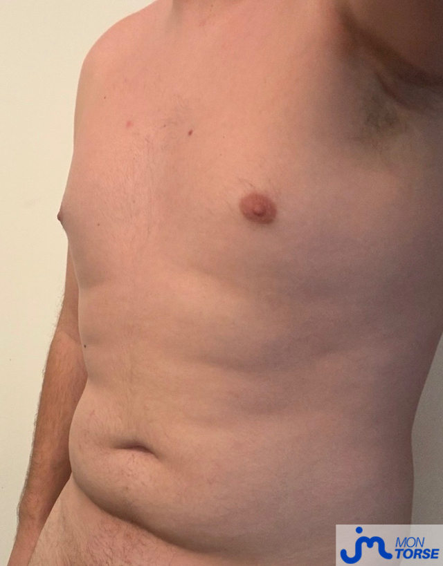 torses de Couplebdsm