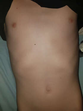 Photos de torses : Maigre 