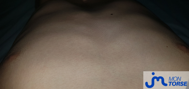 torses de Anonyme0273628