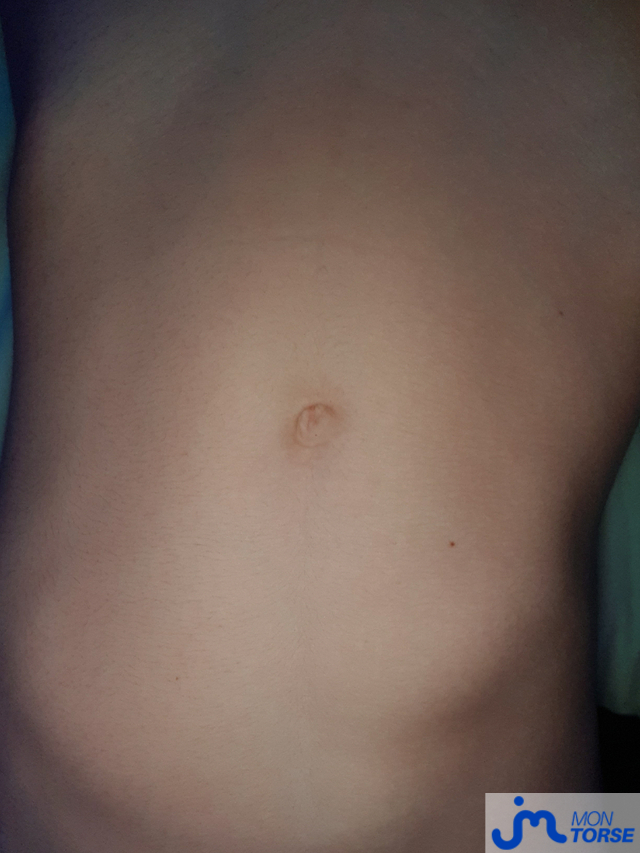 torses de Anonyme0273628