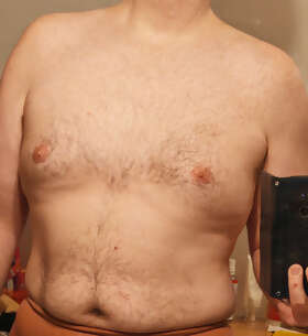 Photos de torses : 1ere contribution