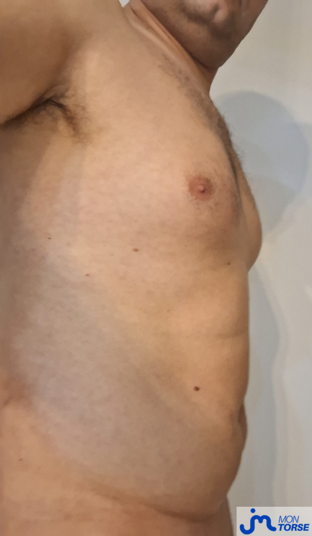 torses de Pacodurhone