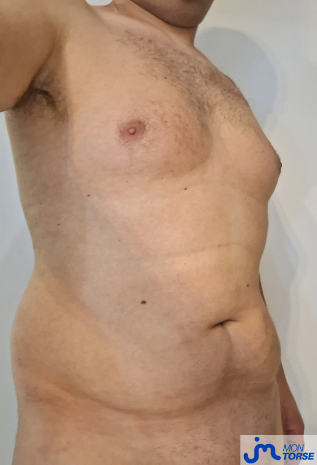 torses de Pacodurhone