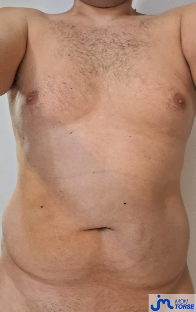 torses de Pacodurhone