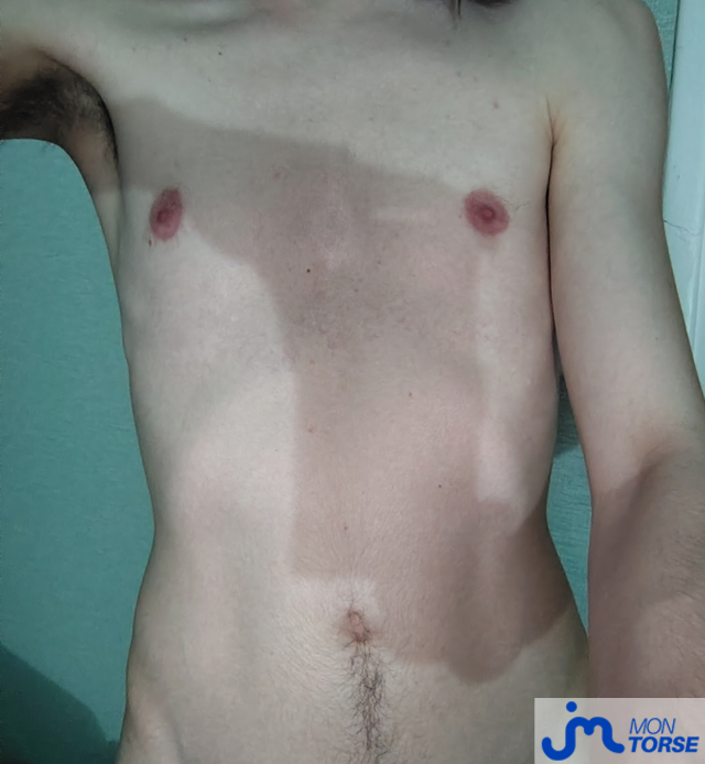 torses de Louis0pieux