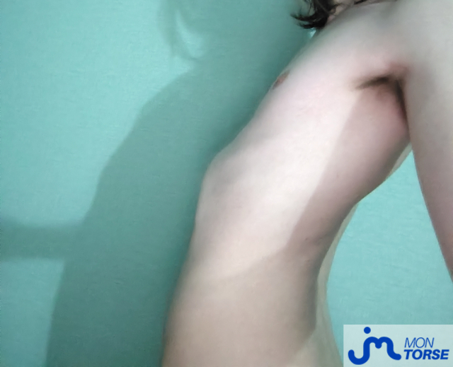 torses de Louis0pieux