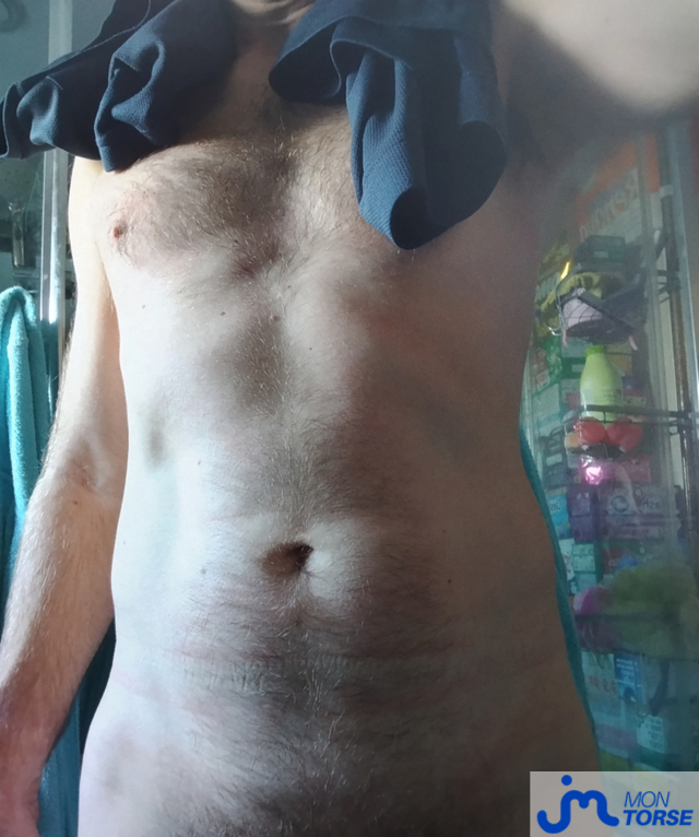 torses de trounormand