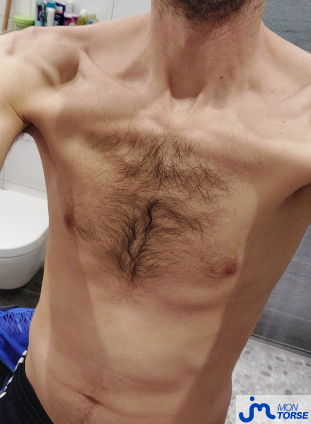 torses de Controleur67000