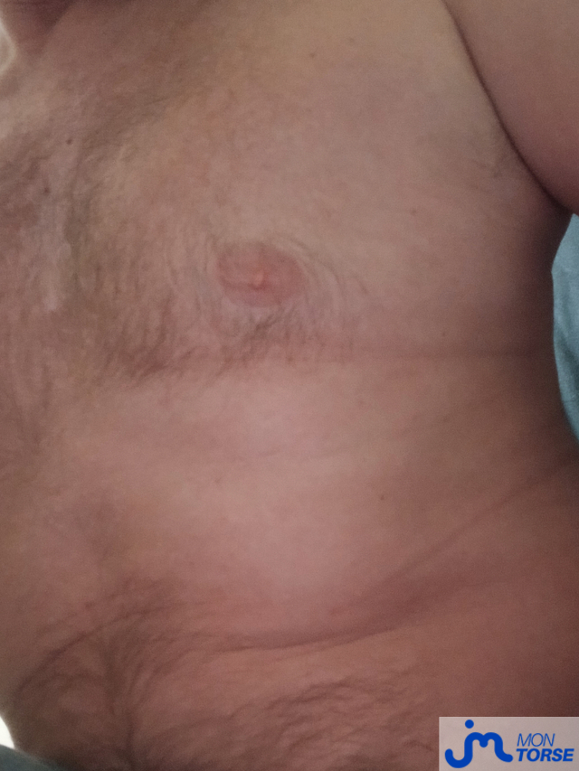 Photos de torses : Le1er