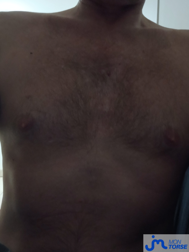 torses de Libertinbzhdu56