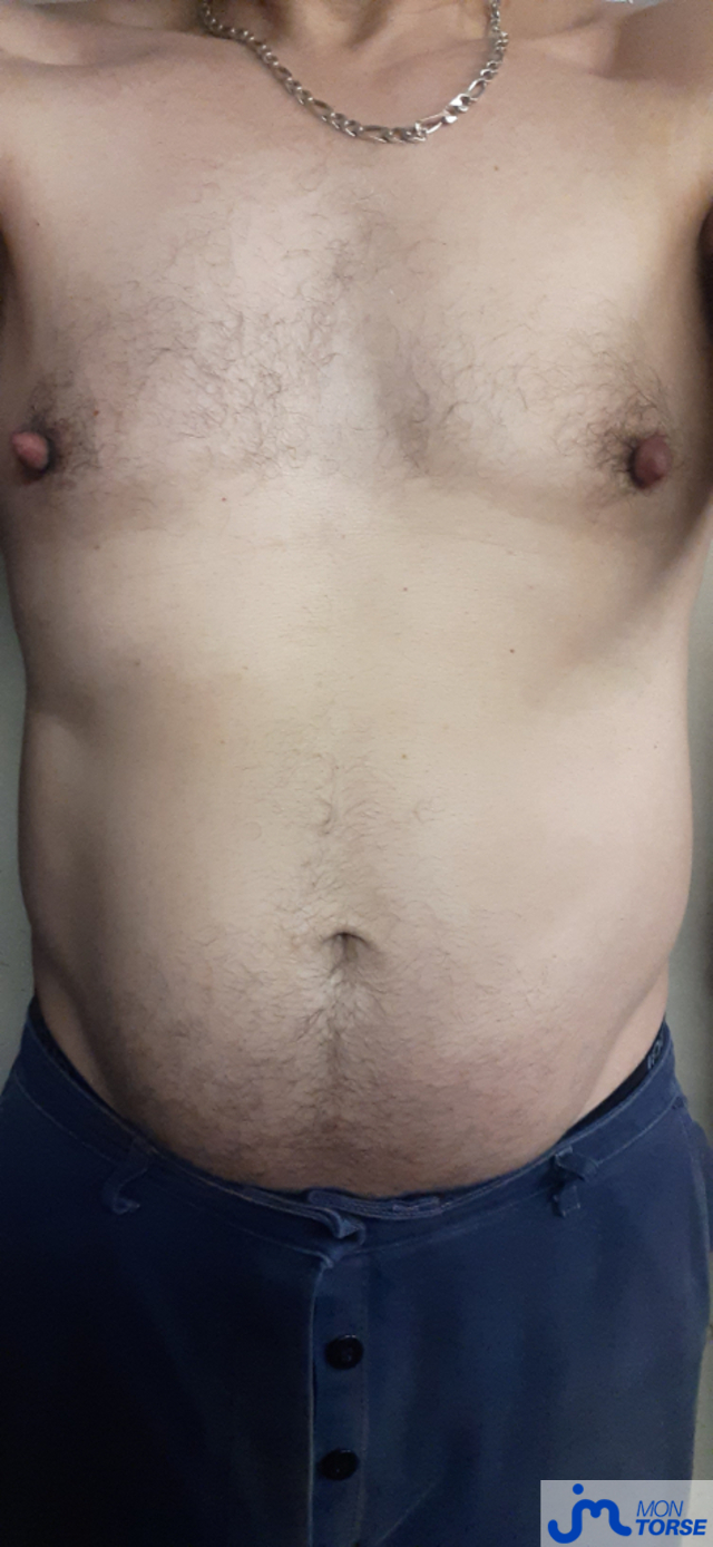 torses de Tire dessus 