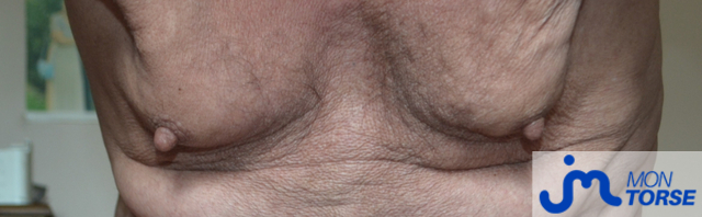 torses de Am&eacute;d&eacute;