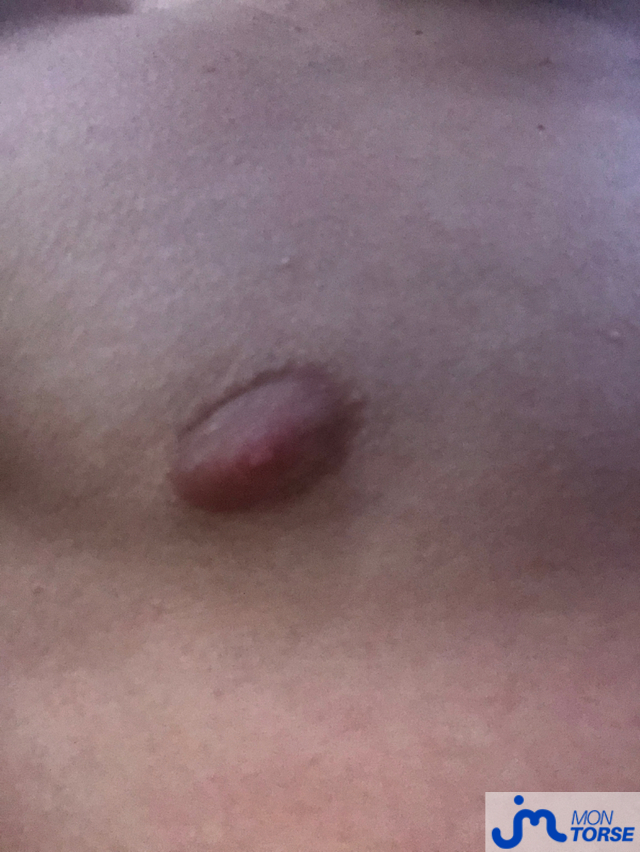 torses de Diego_027