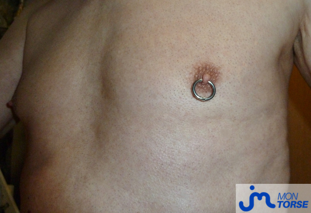 torses de Jacquou82