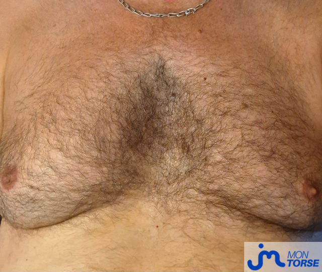 torses de lou88